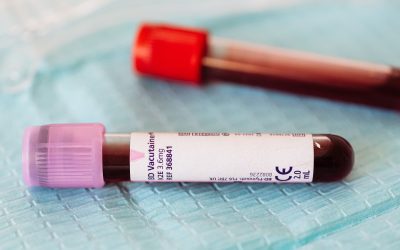 How to Read Your Kidney Labs Without Panic (and What to Watch Over Time)